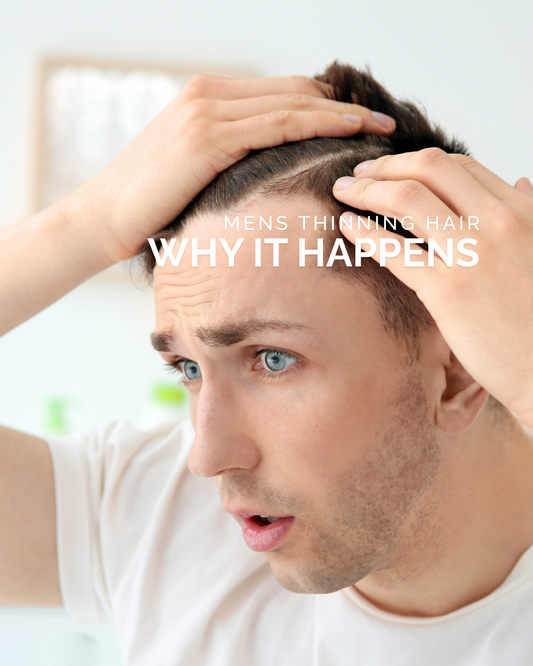 Men’s Thinning Hair