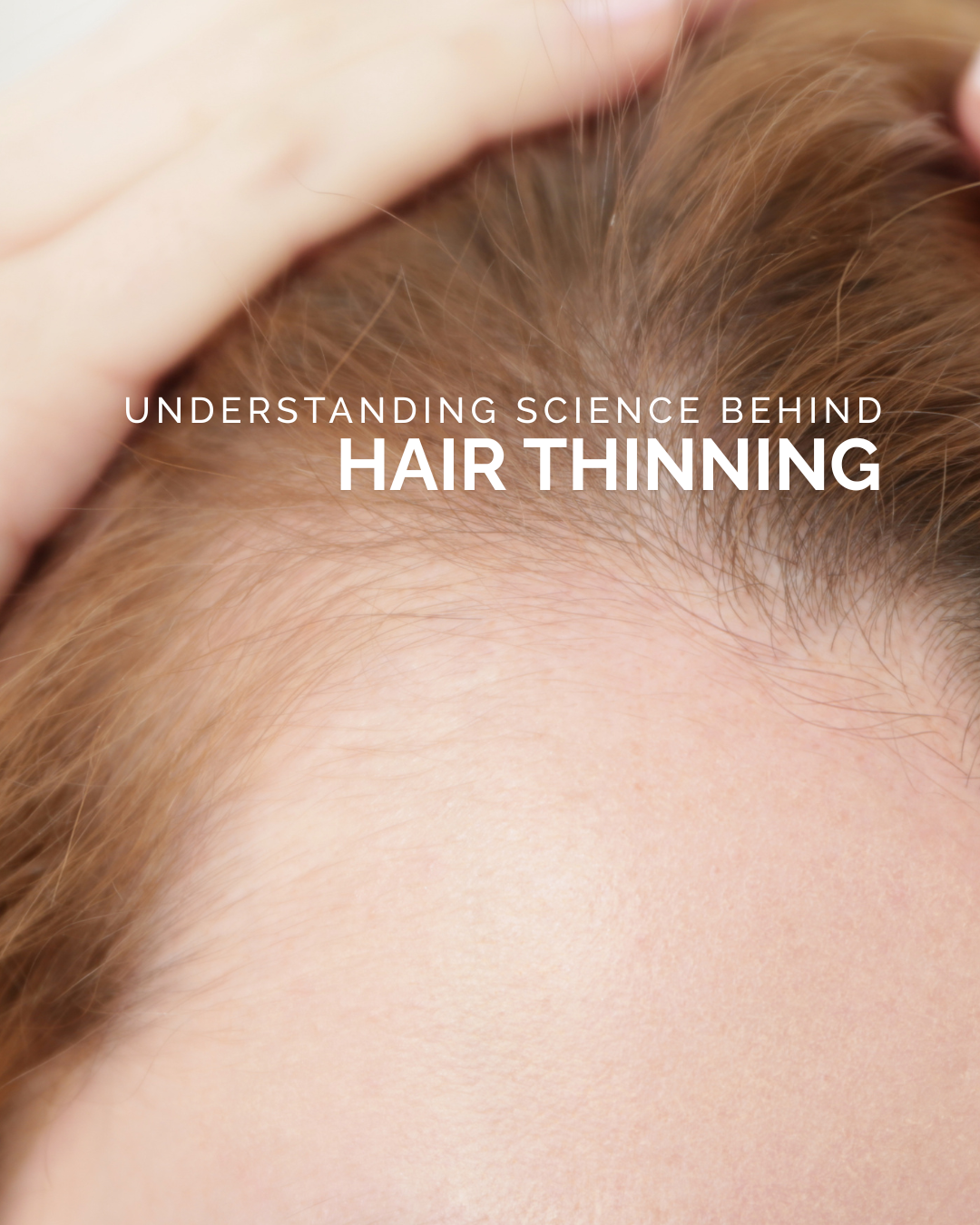 Understanding the Science Behind Hair Thinning